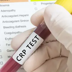 Ręka w rękawiczce trzyma probówkę z krwią do badania CRP TEST. Na tle widoczna lista badań, m.in. białko c reaktywne.