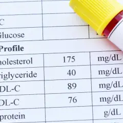 Wynik lipidogramu: cholesterol całkowity 175, triglicerydy 40, HDL 89, LDL 76. Wynik ten pomaga ocenić ryzyko chorób serca, uwzględniając cholesterol nie-HDL.