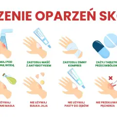 Porady dotyczące leczenia oparzeń skóry: chłodna woda, maść z antybiotykiem, zimny kompres, tabletki przeciwbólowe, sok z aloesu. Unikaj masła, jajka, pasty do zębów, przekłuwania pęcherzy i lodu.