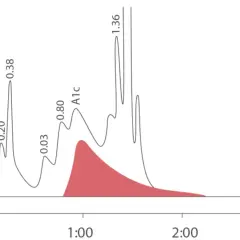 Wykres chromatograficzny z zaznaczonym pikem A1c, wskazującym na poziom glikemii.