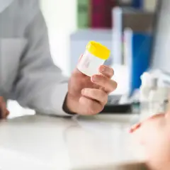 Lekarz w białym fartuchu podaje pacjentowi pojemnik na badanie kału.