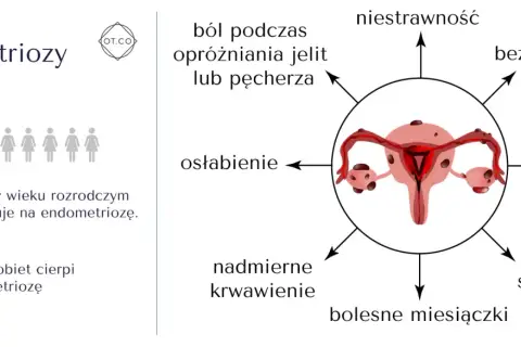 Objawy endometriozy: ból, niestrawność, bezpłodność, mdłości, bolesny stosunek, bolesne miesiączki, nadmierne krwawienie, osłabienie. 1 na 10 kobiet choruje.