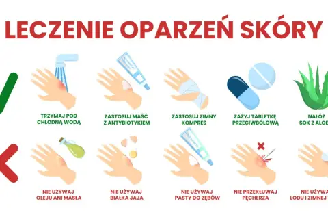 Porady dotyczące leczenia oparzeń skóry: chłodna woda, maść z antybiotykiem, zimny kompres, tabletki przeciwbólowe, sok z aloesu. Unikaj masła, jajka, pasty do zębów, przekłuwania pęcherzy i lodu.