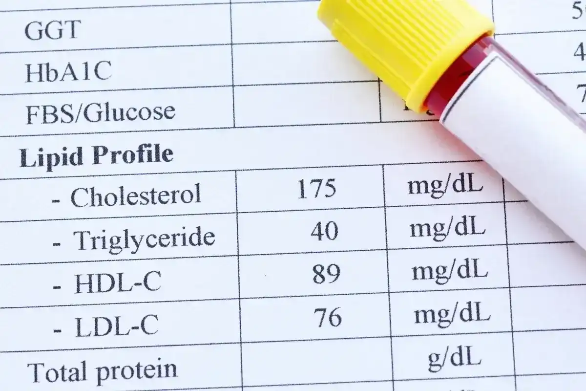 Cholesterol nie-HDL - jak obliczyć i odczytać wynik?
