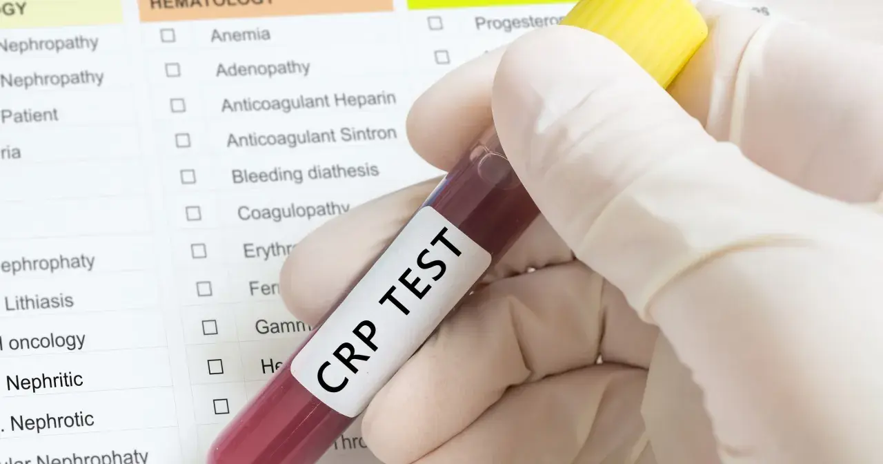 Ręka w rękawiczce trzyma probówkę z krwią do badania CRP TEST. Na tle widoczna lista badań, m.in. białko c reaktywne.