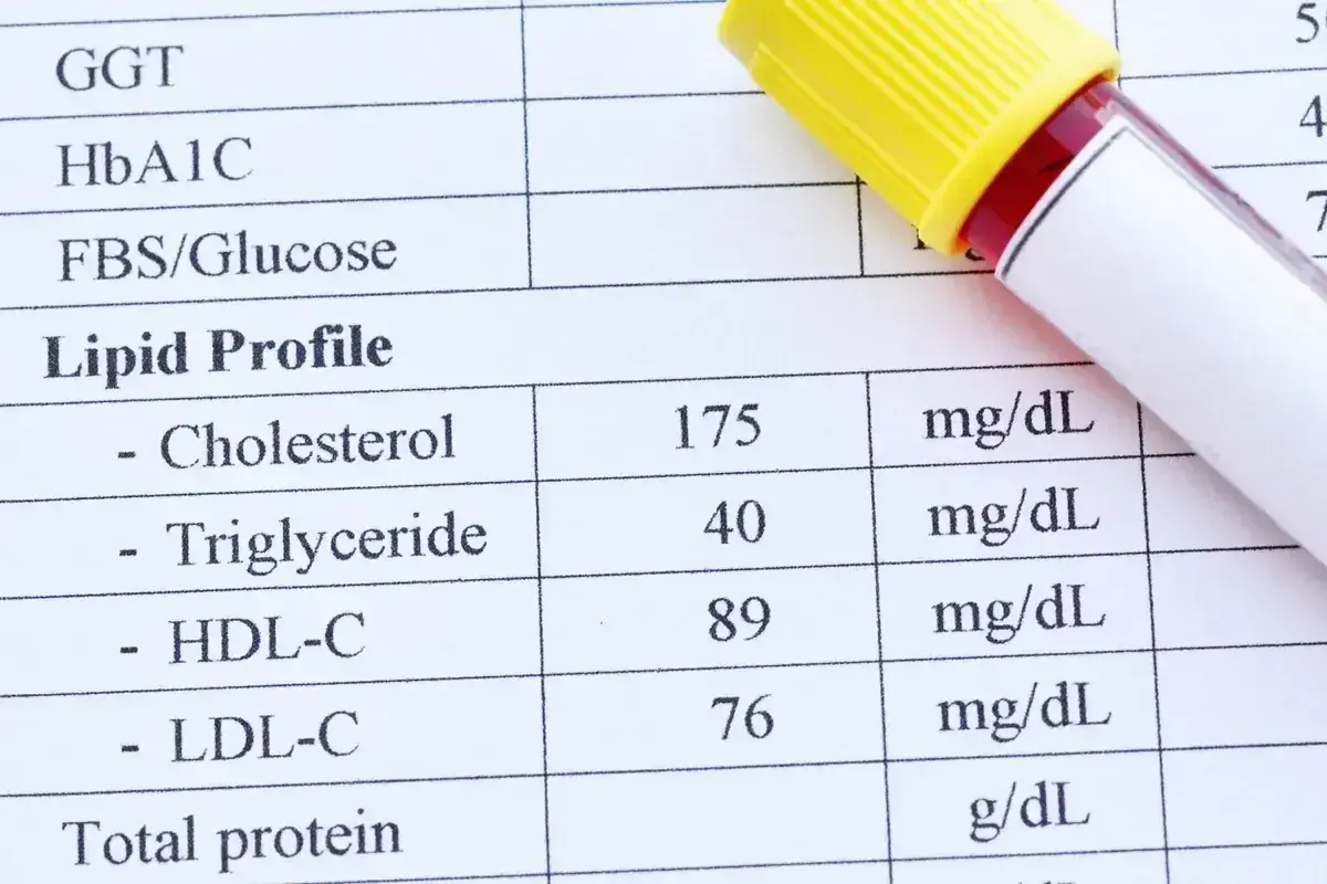 Wynik lipidogramu: cholesterol całkowity 175, triglicerydy 40, HDL 89, LDL 76. Wynik ten pomaga ocenić ryzyko chorób serca, uwzględniając cholesterol nie-HDL.