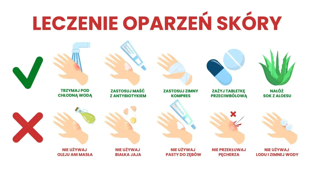 Porady dotyczące leczenia oparzeń skóry: chłodna woda, maść z antybiotykiem, zimny kompres, tabletki przeciwbólowe, sok z aloesu. Unikaj masła, jajka, pasty do zębów, przekłuwania pęcherzy i lodu.