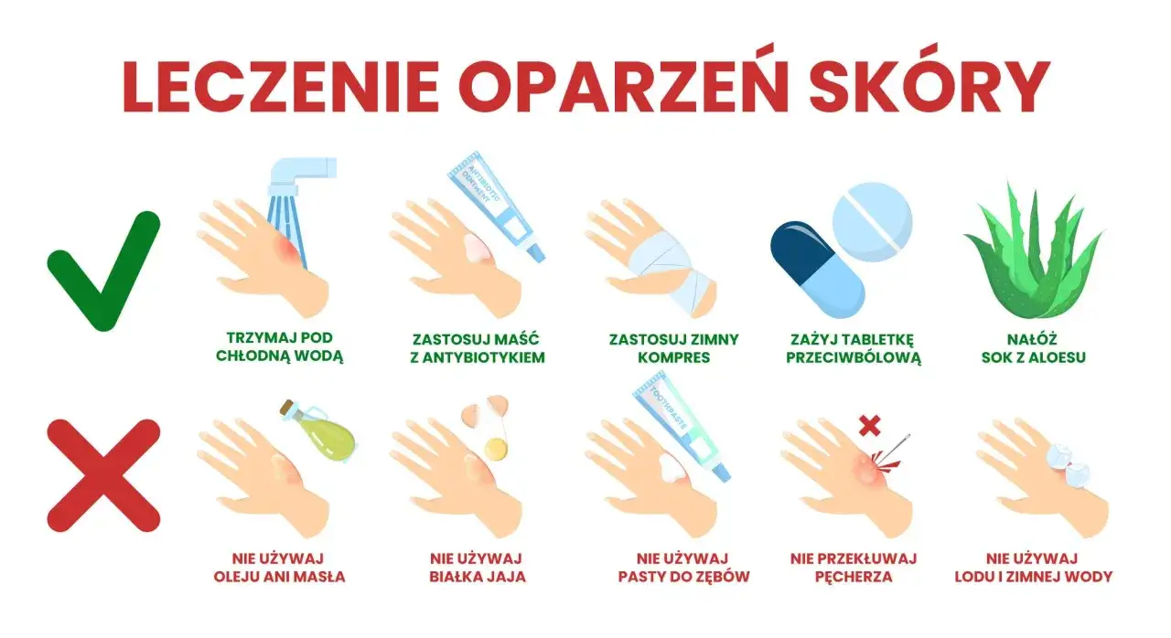 Instrukcja leczenia oparzeń skóry: chłodna woda, maść z antybiotykiem, zimny kompres, tabletki przeciwbólowe, sok z aloesu. Unikaj masła, jajka, pasty do zębów, lodu. Nie przekłuwaj pęcherza.