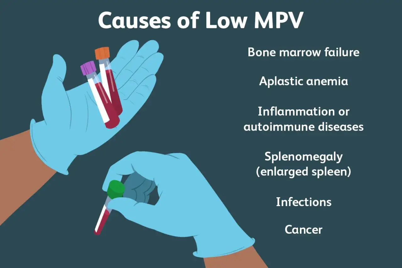 Przyczyny niskiego MPV: niewydolność szpiku, anemia aplastyczna, choroby zapalne, powiększenie śledziony, infekcje, nowotwory.